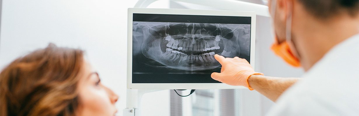 Digital X-Rays | Cosmetic Dentistry Center MA