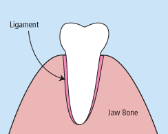 Tooth Extraction | Cosmetic Dentistry Center MA