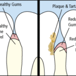 The american dental association is a member of the american dental association.