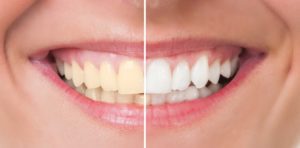 The american dental association is a member of the american dental association.